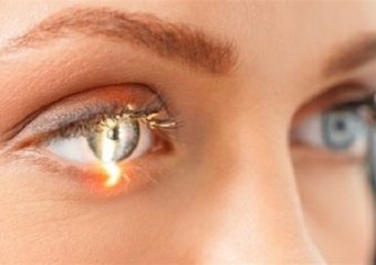 Як запобігти сліпоті від глаукоми