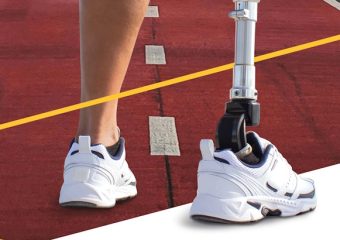 Як і де отримати послуги з безоплатного ендопротезування?